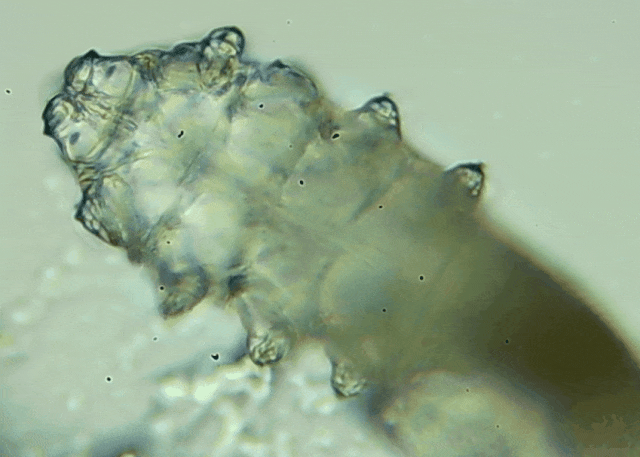 睫毛上驚現(xiàn)80只螨蟲！別揉了，快自查下你的眼睛有沒(méi)有......