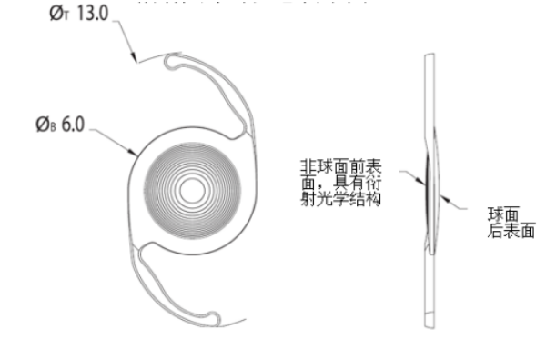 愛爾康三焦點(diǎn)